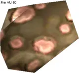 Aurli Chitin Scale
