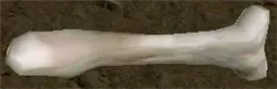 Bone