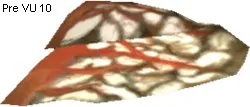 Cornundacauda Sail