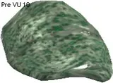 Erdorium Stone