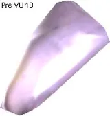 Metallic Bone Replacement