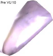 Metallic Bone Replacement