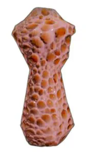 Trabecular Augmented