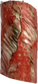 Turp Skin